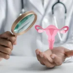 Deteksi Dini Kanker Serviks dengan Teknologi AI 2025